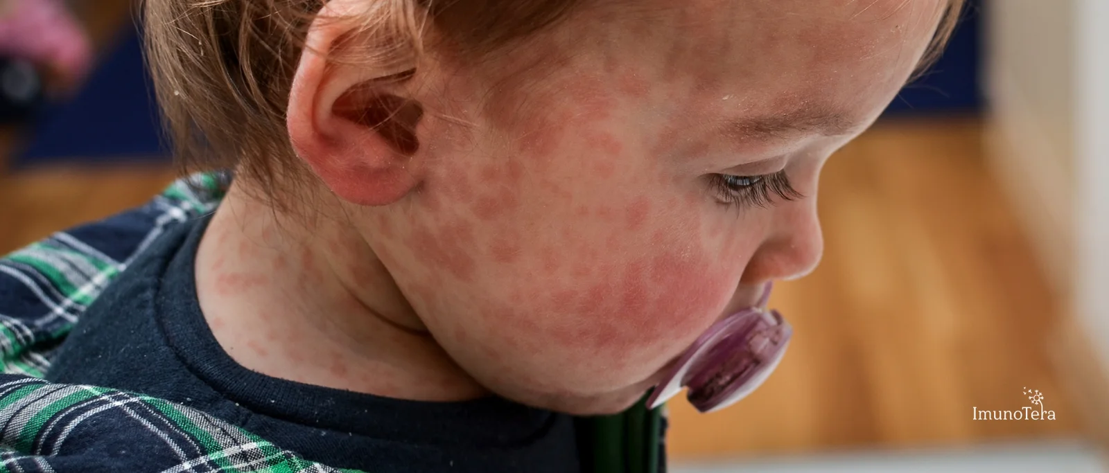 Histamino netoleravimo priežastys ir mechanizmai