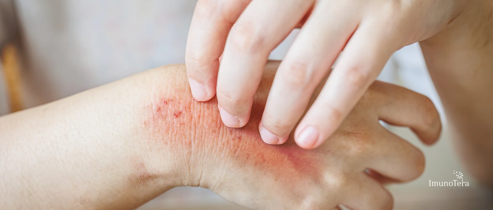 Vaistai, galintys sukelti fotojautrumo reakcijas