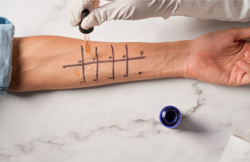 Imunologiniai, alerginiai tyrimai Vilnius