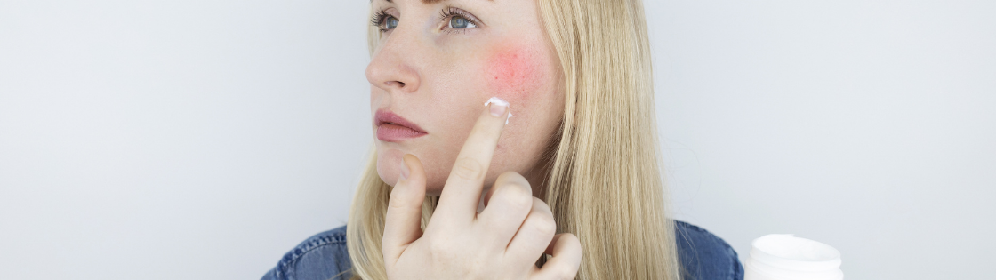 Maisto alergenai kosmetikoje