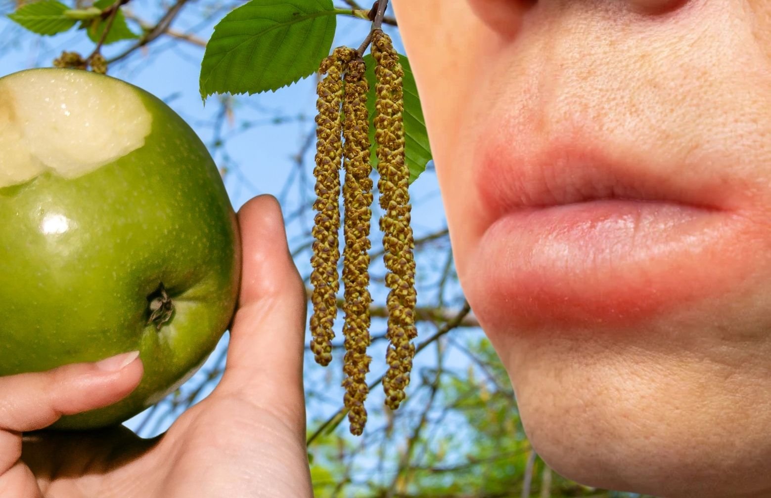 Alergija beržui ir alergija obuoliams - kas jas sieja