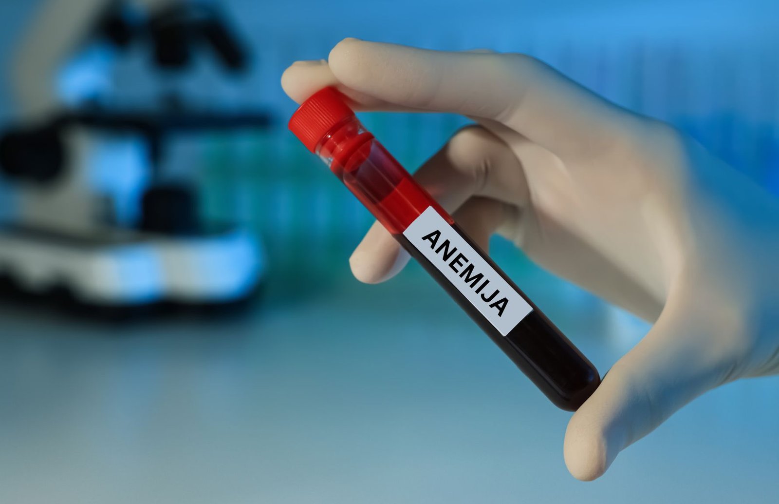 Anemija vaikams: simptomai, priežastys ir kada kreiptis į hematologą